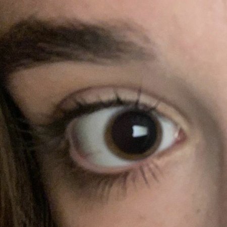 Большие зрачки