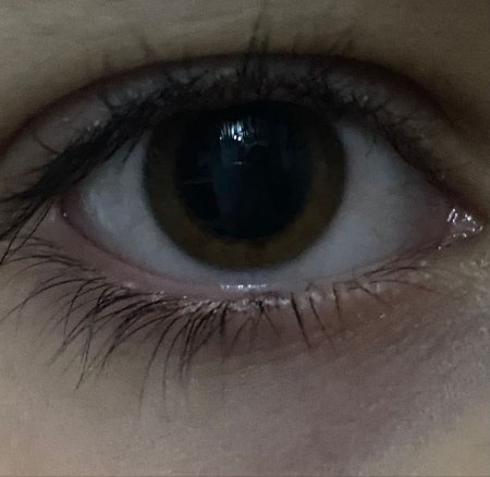 Большие зрачки