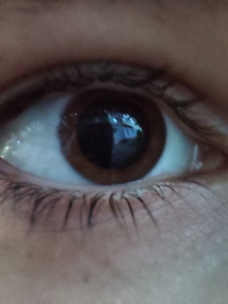 Глаза с большими зрачками