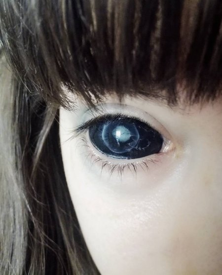 Татуировка на глазном яблоке