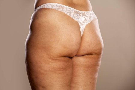 Старые ягодицы