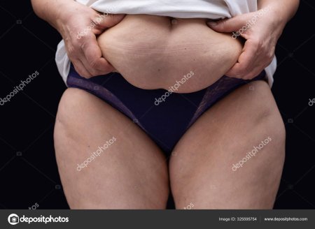 Жирные целлюлитные животы