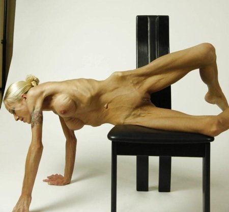 Голые анорексичные женщины