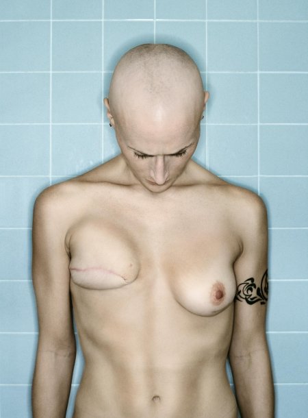 Необычная форма груди