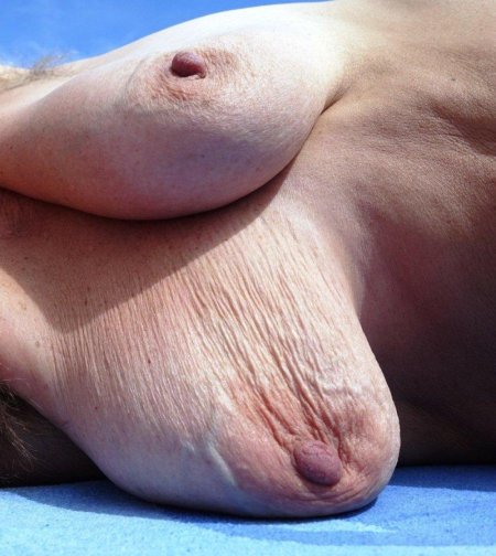 Здоровая грудь