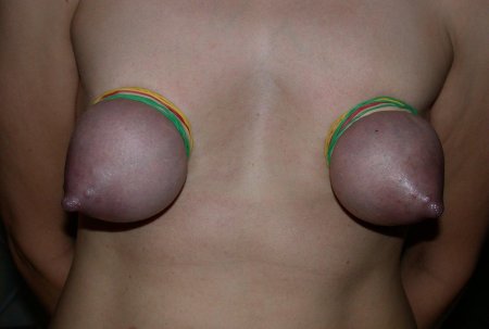 Сильно перетянутые сиськи