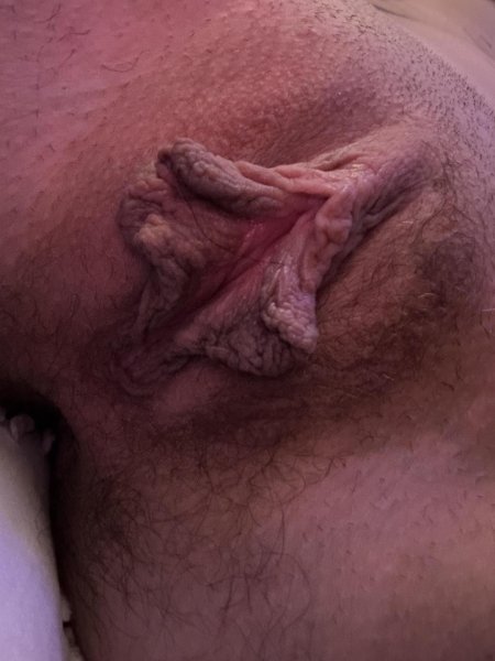 Большая половая губа