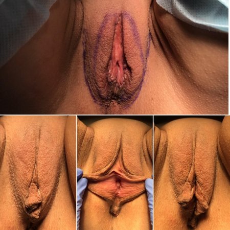 Красива вагина