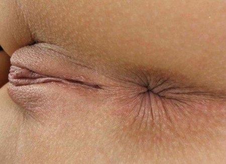 Женские анус