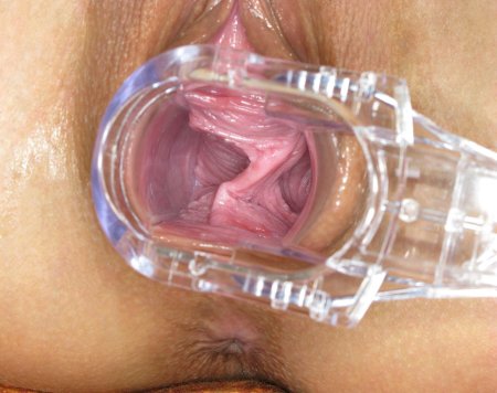 Влагалище изнутри