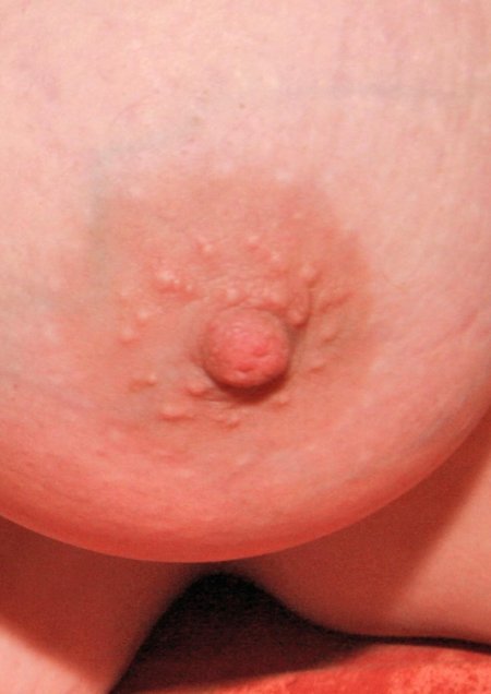 Женские соски