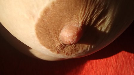 Большие коричневые ареолы