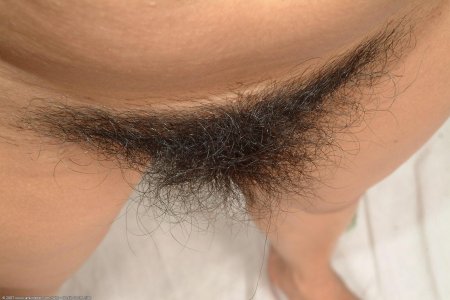 Лобковые волосы