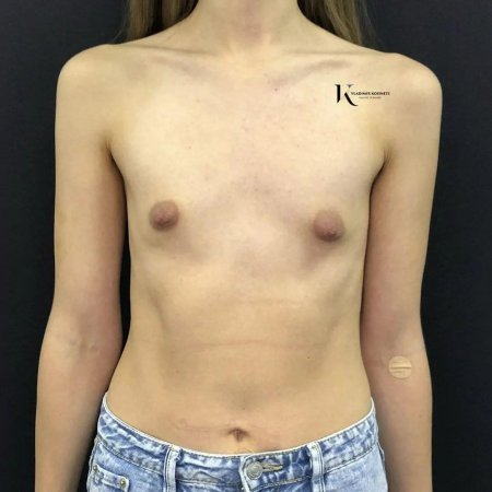 Грудь нулевка