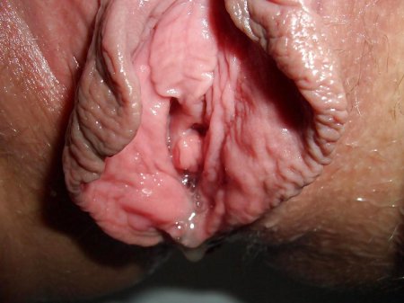 Старые половые губы