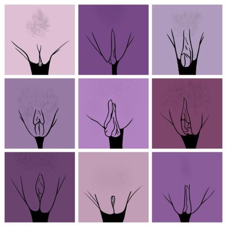 Формы женских влагалищ