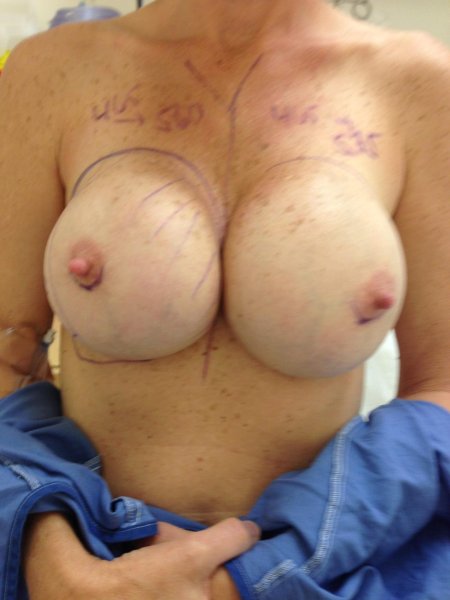 Красивая грудь с имплантами