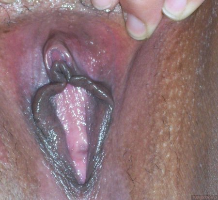 Бразильское влагалище