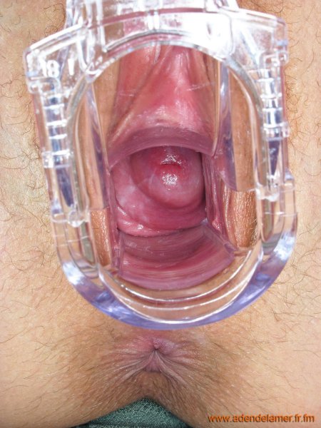 Здоровое влагалище изнутри