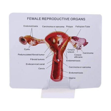 Матка анатомическая модель