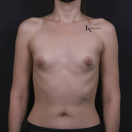 Сиськи нулевого размера