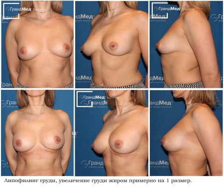 Размера груди