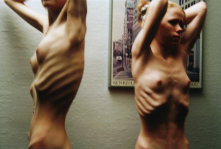 Обнаженка анорексички