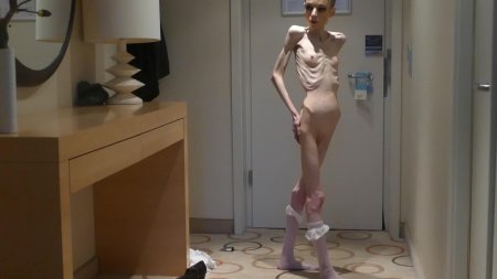 Порноактрисы анорексия