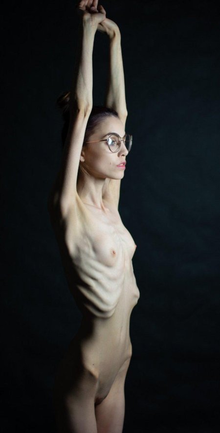 Голые анорексички