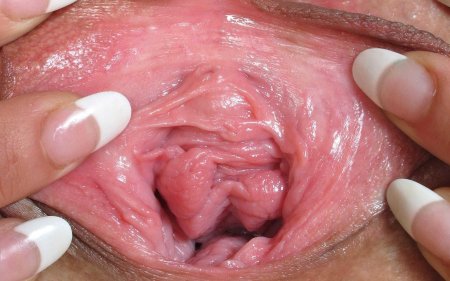 Преддверие влагалища