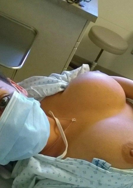 Операция по увеличению груди