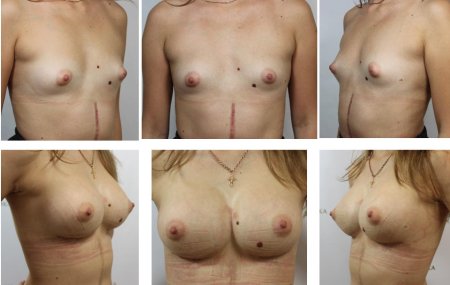 Женская грудь разного размера