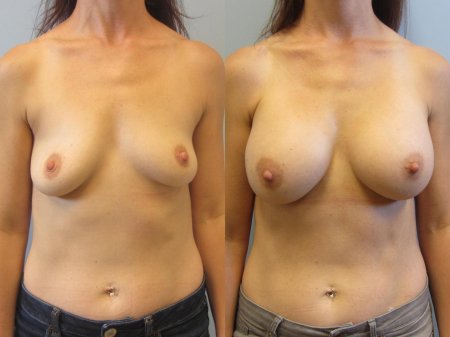 Идеальная сиська