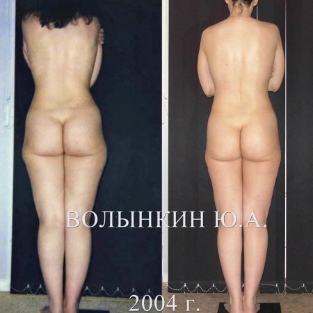 Массаж бразильские ягодицы