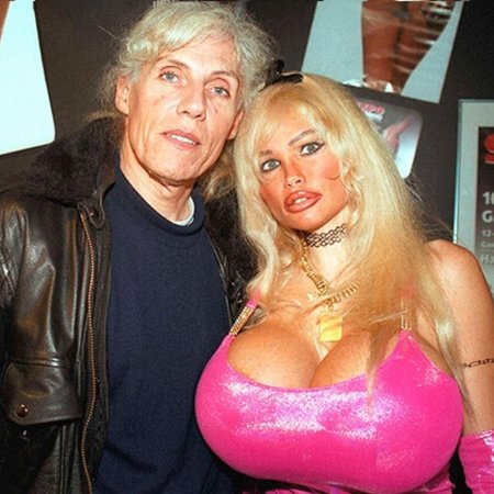 Лоло феррари до и после операции