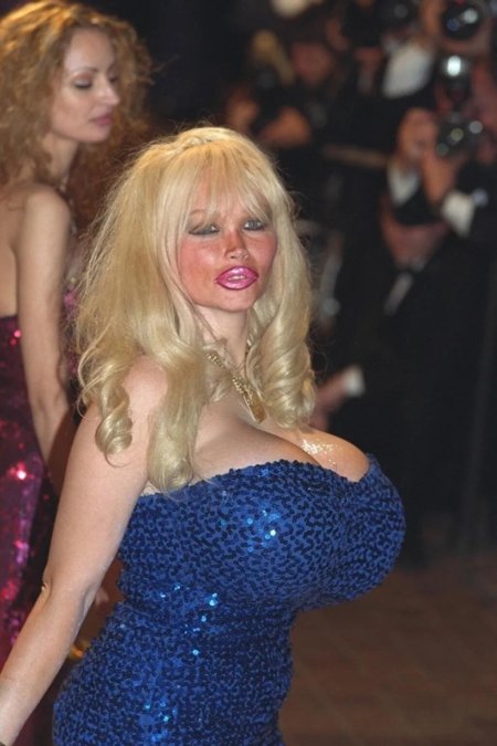 Лоло феррари