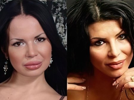 Оксана самойлова до пластики