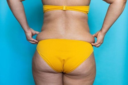Женские бедра с излишним весом