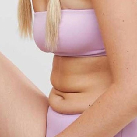 Складка на животе