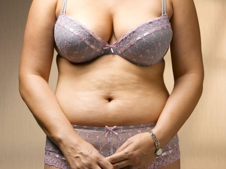 Женщины с жирком