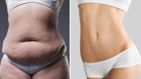 Огромный целлюлитный живот