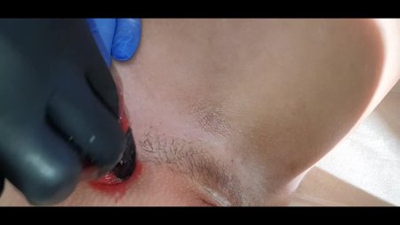 Шугаринг глубокое бикини мужчинам