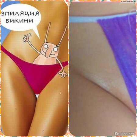 Зона бикини