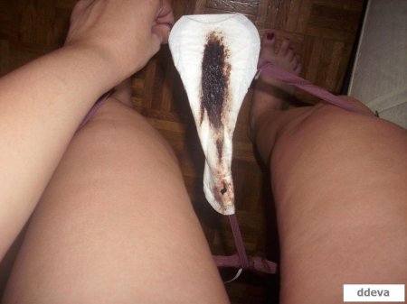 Коричневое выделение