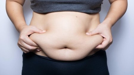 Большой живот