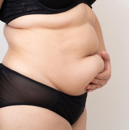 Толстая женщина в белье