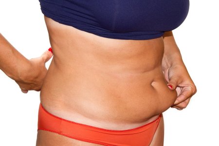 Жировые отложения на животе