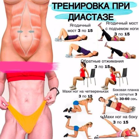 Пресс при диастазе упражнения