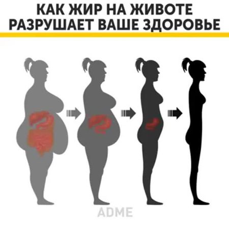 Висцеральный жир на животе у женщин