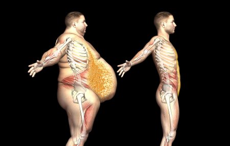 Ожирение живота у мужчин